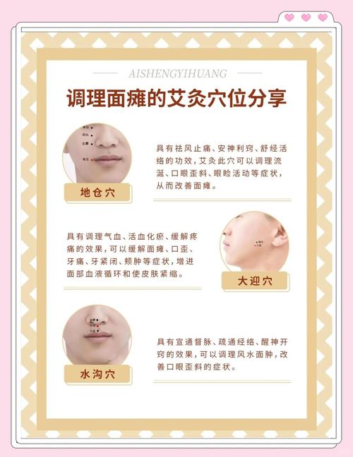 面肌痉挛艾灸什么穴位