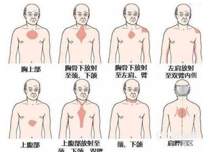心梗脑梗患者会疼痛吗