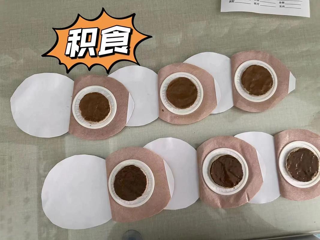 自制中药穴位贴敷疗法