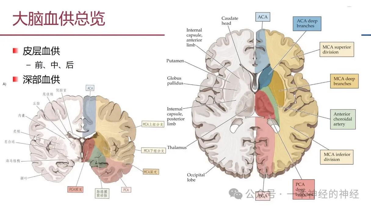 脑梗与腔梗的区别图示