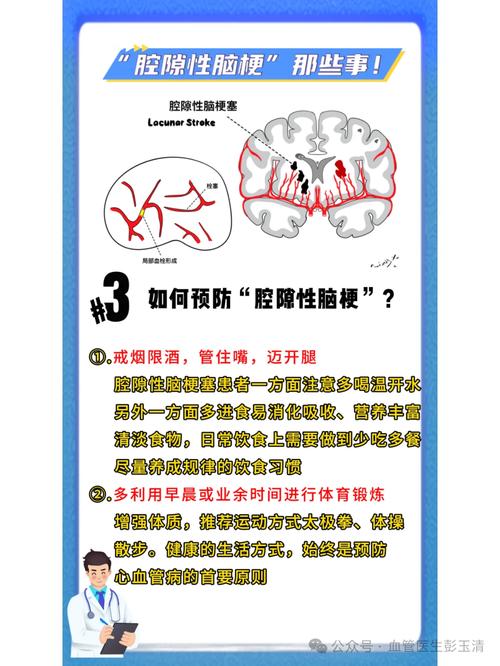 脑梗腔梗怎么治疗方法