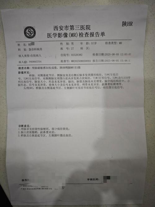 青岛 医院 脑梗堵