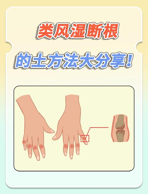 风湿和类风湿治疗土方