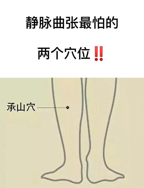 精索静脉曲张按摩穴位