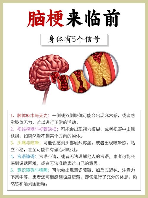 脑梗每天15000步