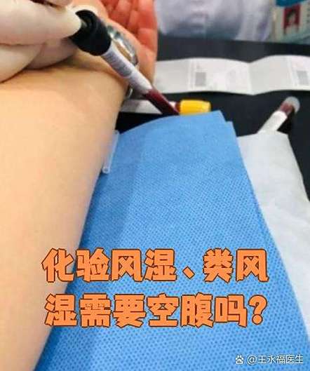 风湿类风湿验血空腹吗