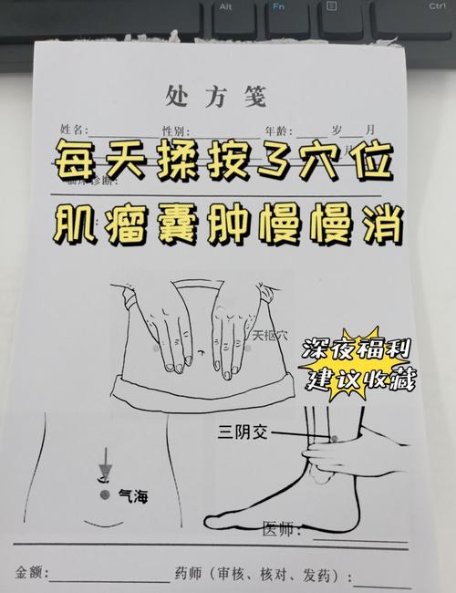 子宫肌瘤艾灸那些穴位