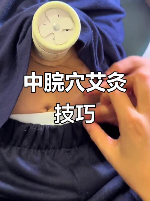 肠胃不好艾灸什么穴位