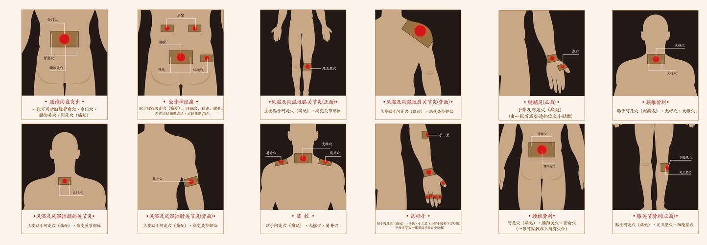风湿类风湿静电理疗贴