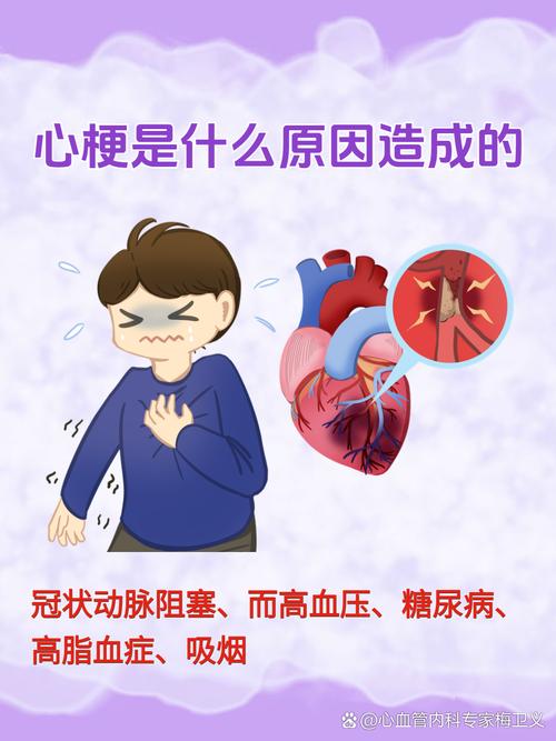 急性心梗会导致脑梗吗