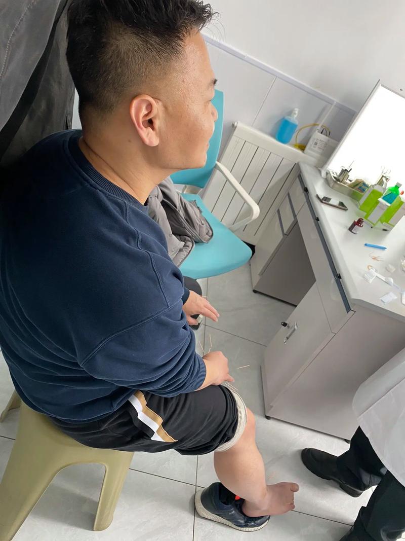 针灸治疗类风湿和风湿