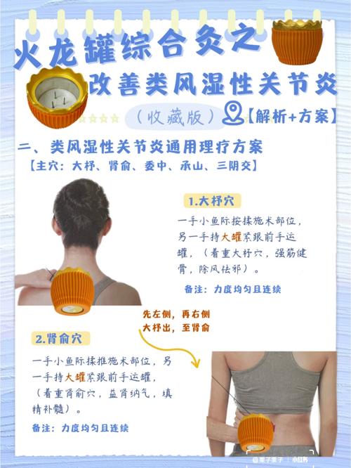 风湿类风湿咋治疗方法