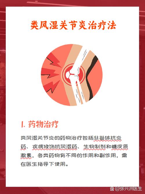 风湿类风湿咋治疗方法