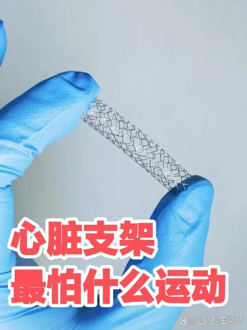 风湿类风湿做心脏支架