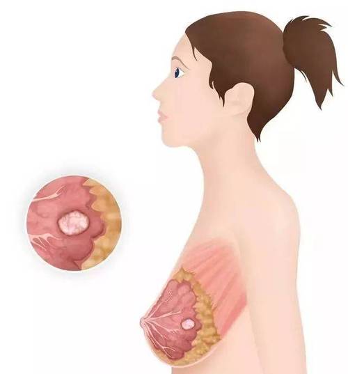 哪些穴位促进乳汁分泌