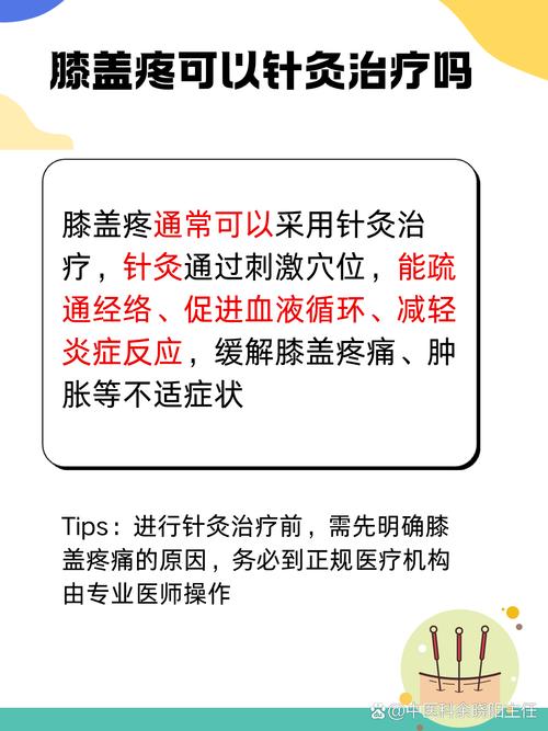 针灸风湿类风湿管用么