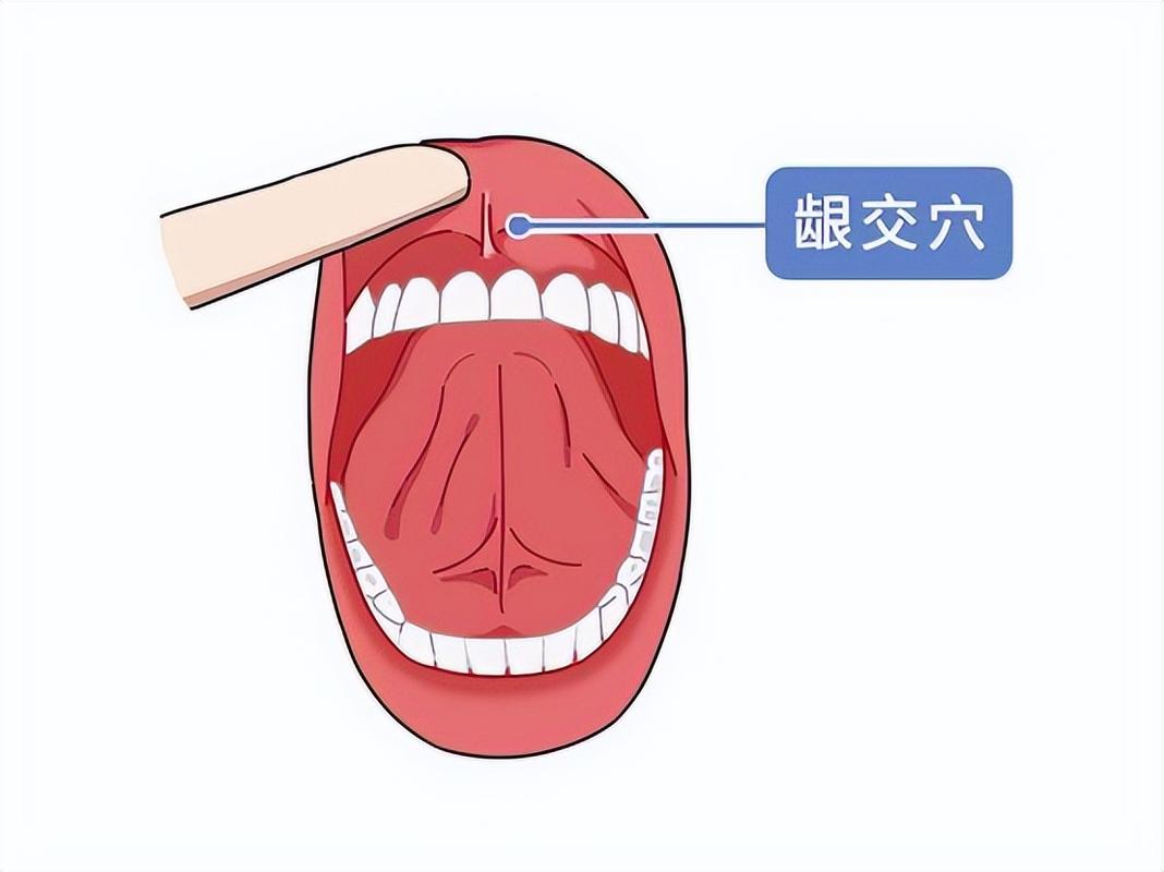 龈交穴位治疗痔疮视频