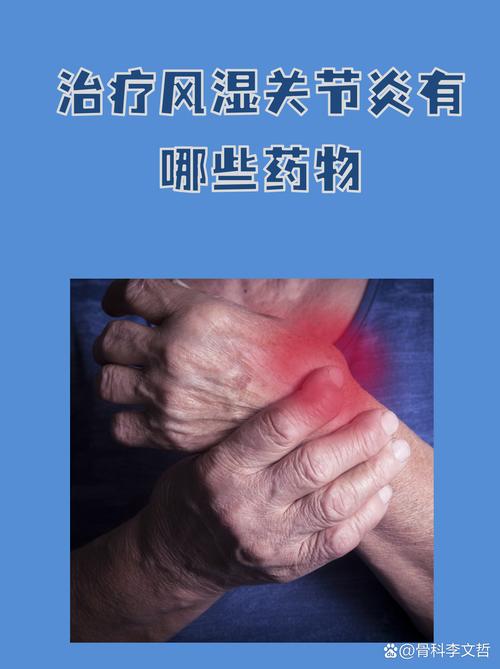 风湿可以输液扛风湿那