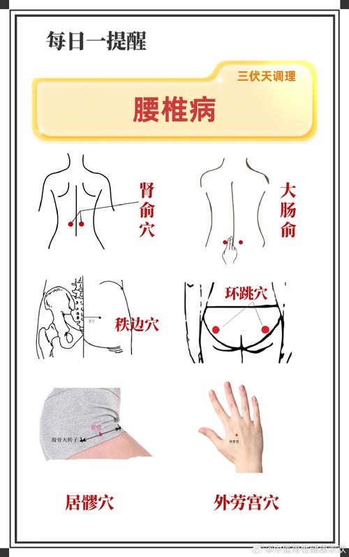 腰肌劳损特效穴位按摩