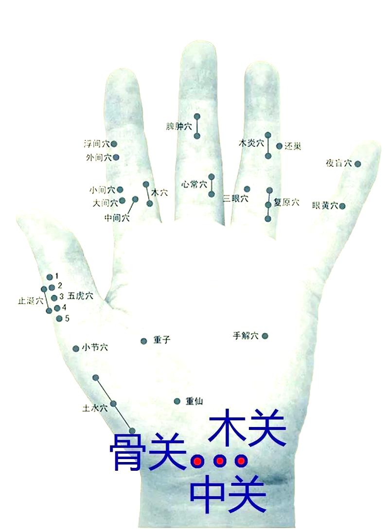 风湿性关节炎治疗穴位