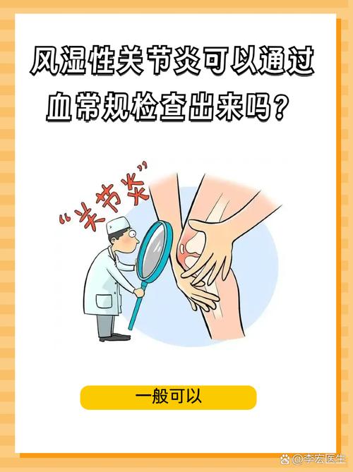风湿疼验血还不是风湿
