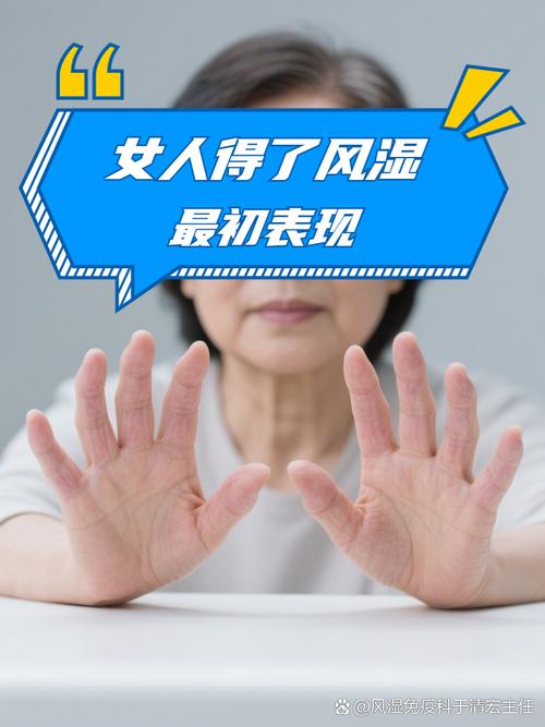 产后风湿变成类风湿吗