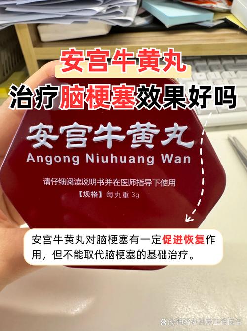 脑哪些中成药能治脑梗