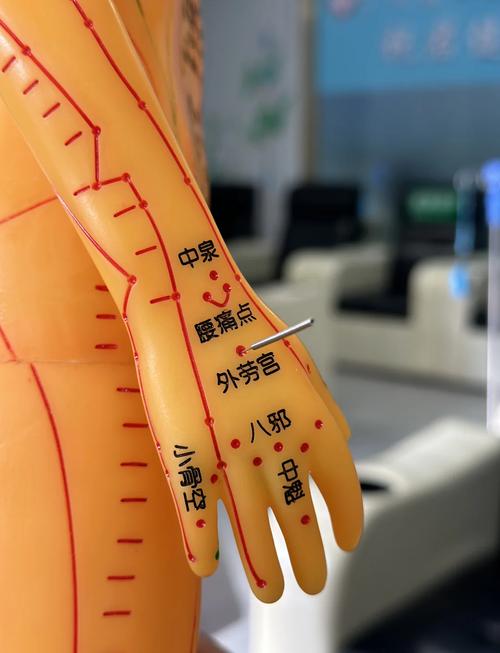 脑溢血后遗症穴位治疗