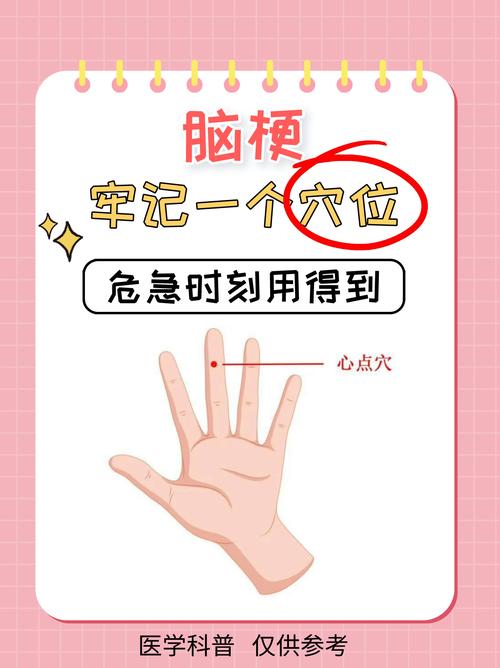 脑溢血后遗症穴位治疗