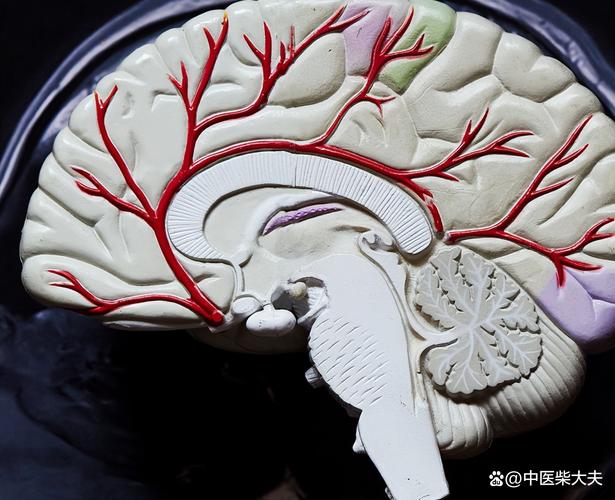 脑内多发缺血灶是脑梗