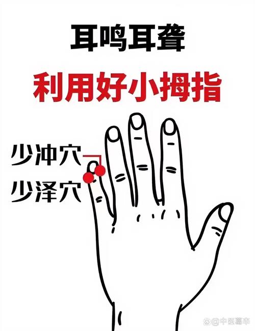 突发性耳聋的穴位治疗