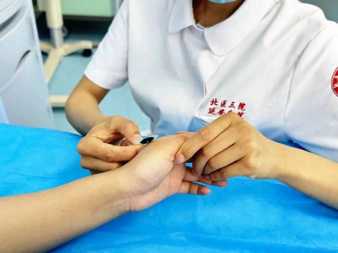 穴位注射西安中医医院