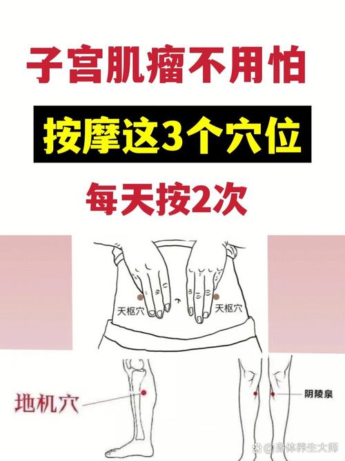 子宫肌瘤按摩哪些穴位