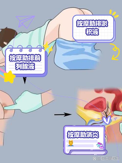 穴位按摩治疗前列腺炎