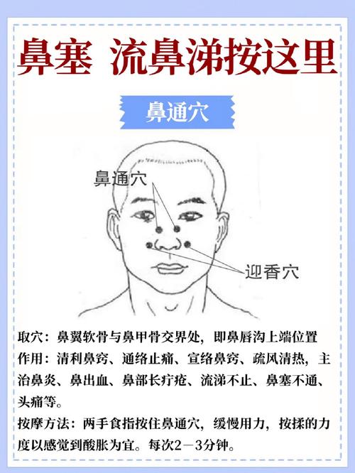 艾灸过敏性鼻炎的穴位