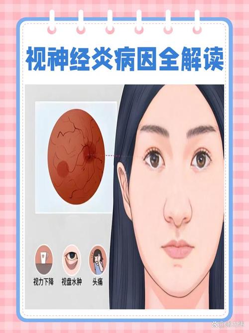 视神经 风湿 类风湿