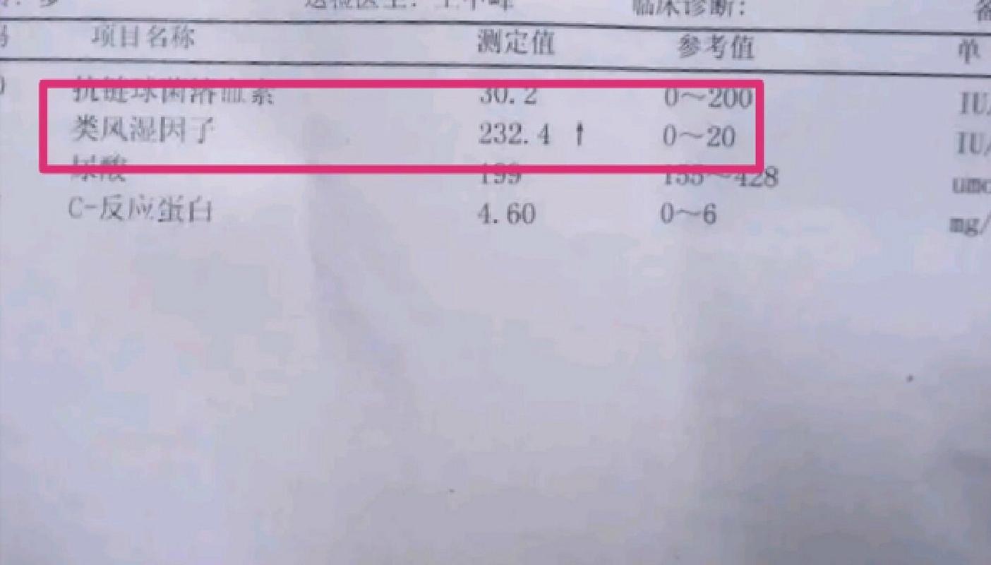 类风湿风湿因子200