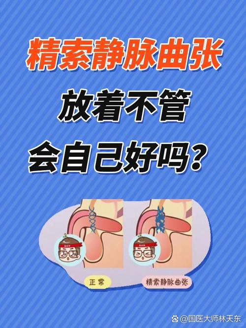 治疗精索静脉曲张穴位