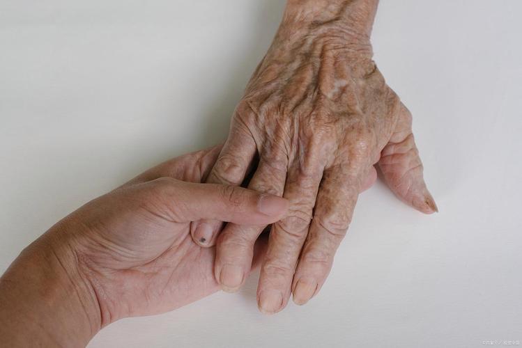 女性风湿 男性 风湿