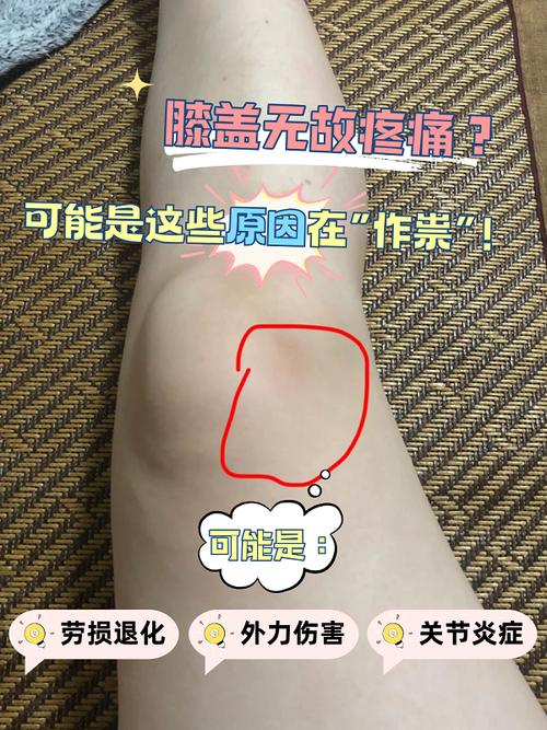 类风湿性关节炎膝盖疼