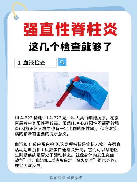 强直性脊柱炎风湿三项