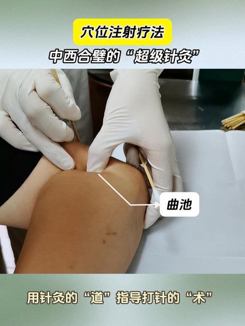 生物离子穴位渗透疗法