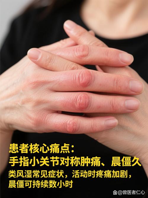 风湿性关节炎会怎么样