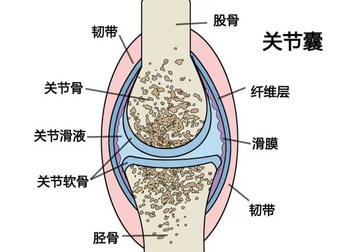 类风湿性关节炎有几种