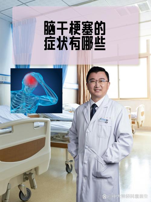 三脑九科医院治疗脑梗