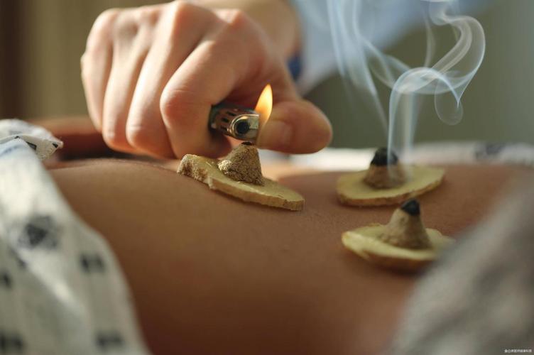 类风湿性关节炎与艾灸