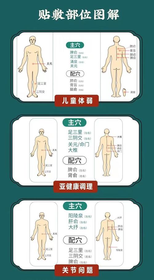 穴位贴敷治疗贴贴哪里