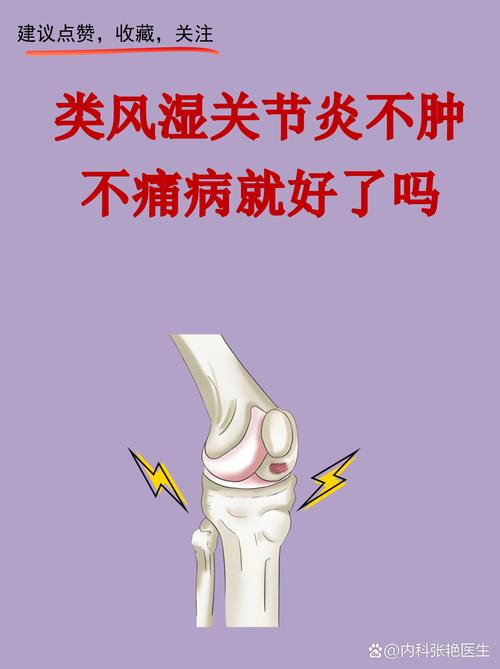 类风湿关节炎最新进展