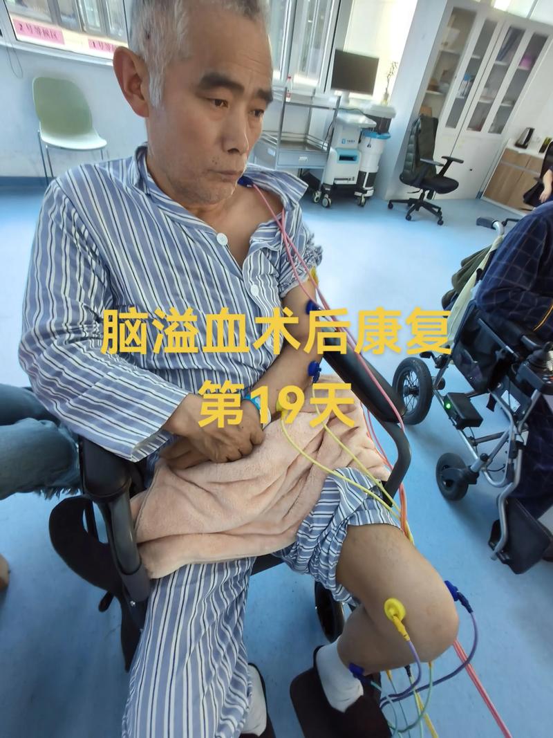 西京医院 康复 脑梗