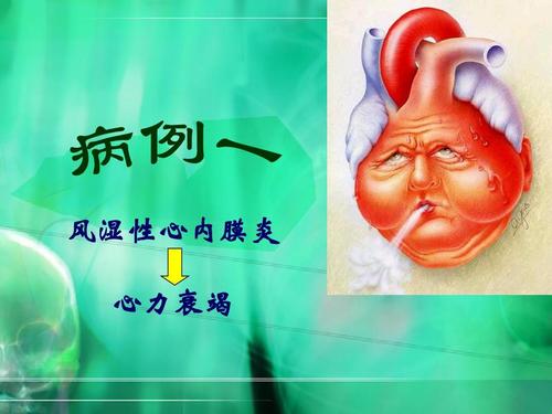 亚急性风湿性心内膜炎